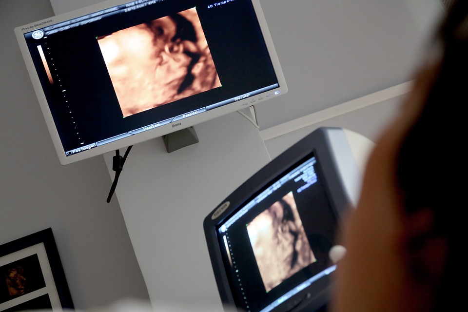 Wpływ wrodzonych wad macicy na ciążę i poród